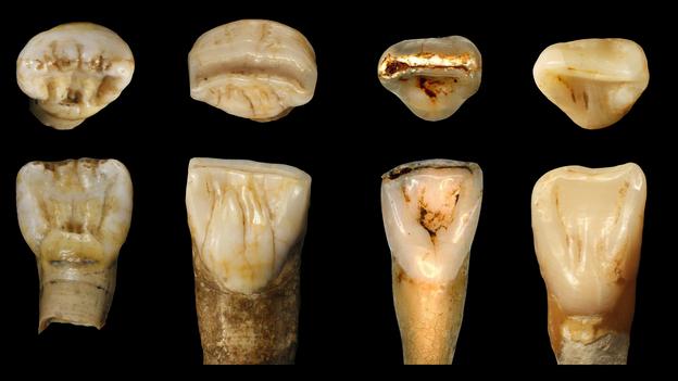 Strange fossils from China don’t seem to fit any known hominin species. Could they be something new? 4